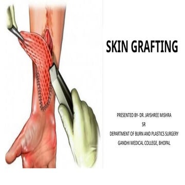 Comprehensive Overview of Skin Grafting Techniques and Management in ...