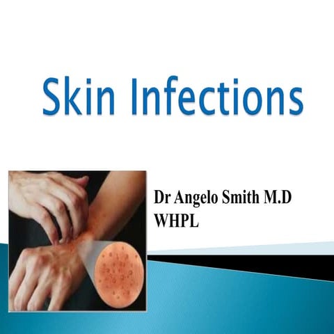 Skin infections
