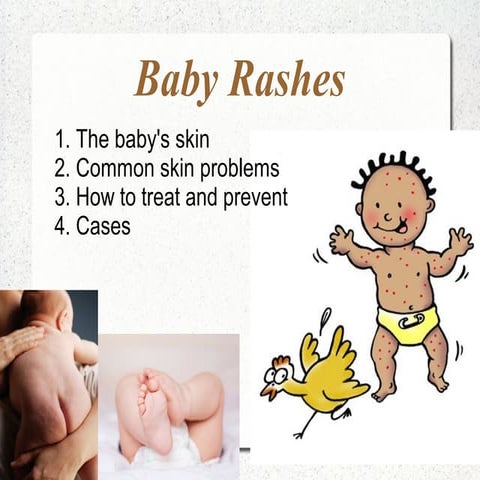 Neonatal paediatric skin diseases