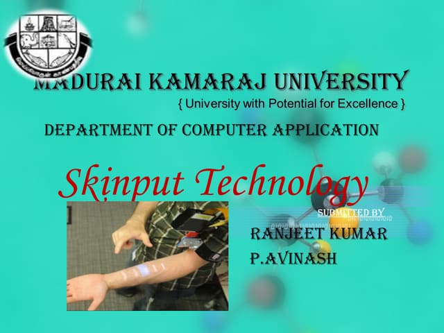 Skinput technology