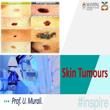 Skin Tumors - Benign And Malignant Tumors