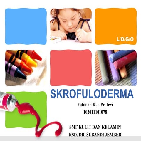 Skrofuloderma