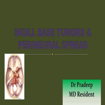 Skull base tumors &amp; perineural spread radiology ppt