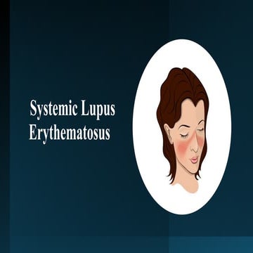 SYSTEMIC LUPUS ERYTHEMATOSUS (SLE | PPTX