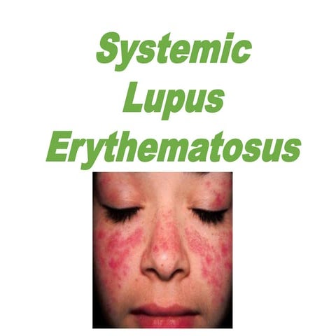 Systemic  Lupus  Erythematosus -SLE PT2.ppt