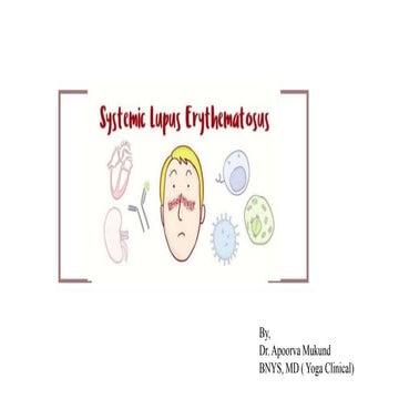 Systemic lupus erythmatosus