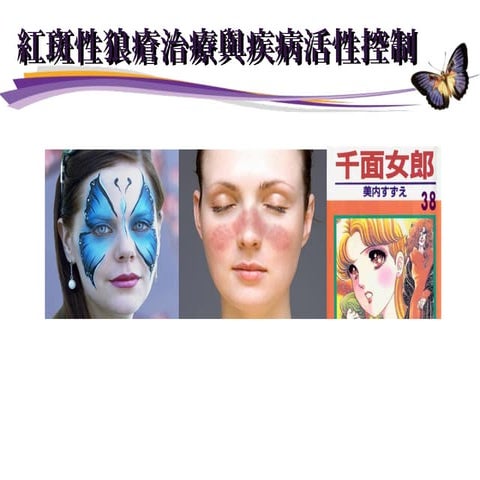 Sle 衛教講座 chen