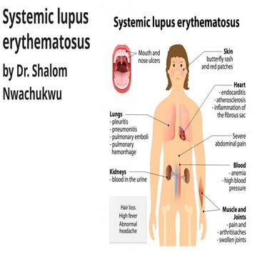 systemic lupus erythematous presentation .pptx