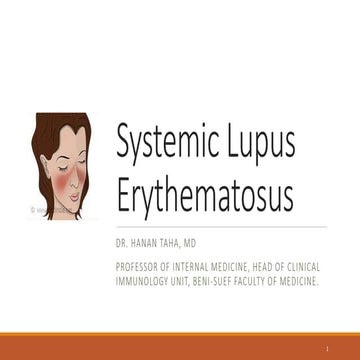 SLE Systemic lupus erythematosus basics 2022 Prof. Hanan Ali Taha
