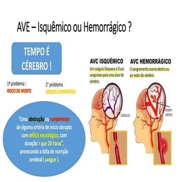 Acidente Vascular Encefálico AVC - AVE.pdf