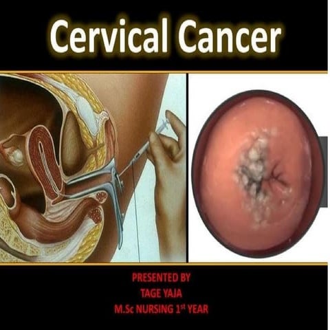 slidesaver.app_jfvlbx (1).pptx adult health nursing