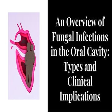 intro and types of fungal infection in oral cavity | PDF