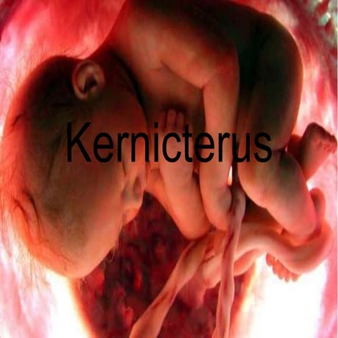 Kernicterus | PPTX