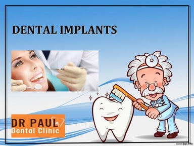 Dental Implants