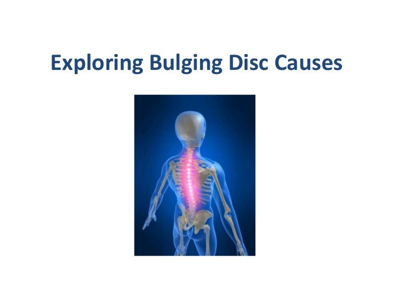 Exploring Bulging Disc Causes