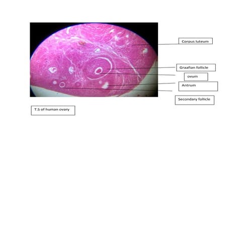 photographs of  CBSE class 12  biology slides labelled