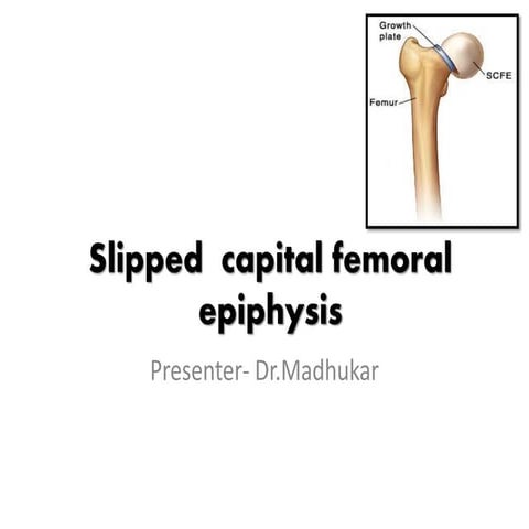 Slipped  capital femoral epiphysis