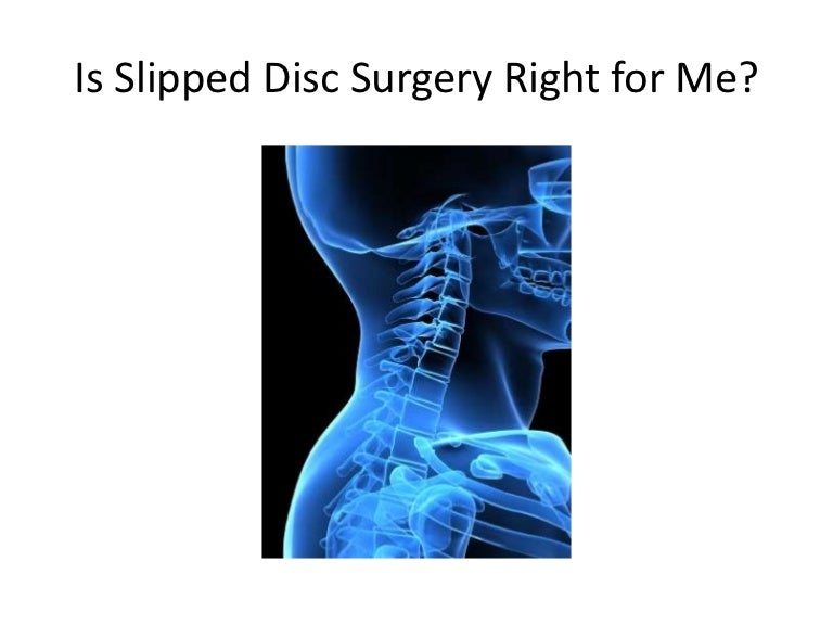 Slipped Disc Surgery