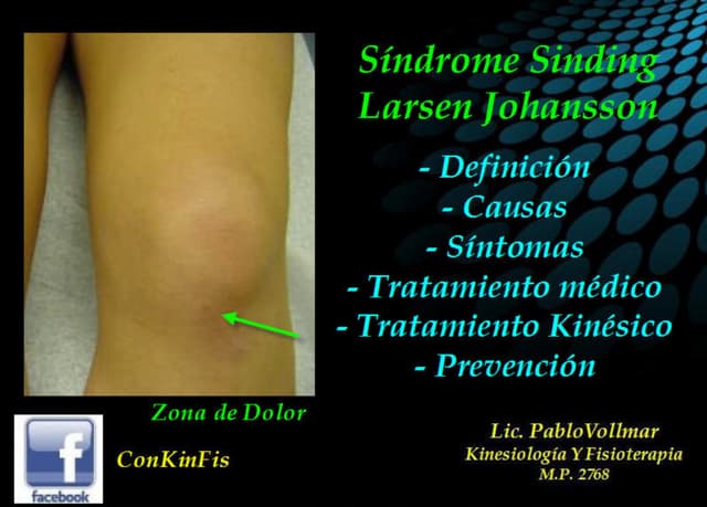 Sindrome Sinding-Larsen- Johansson | PDF