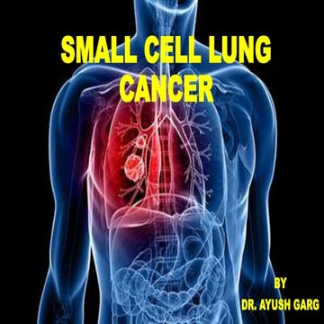 Small cell lung cancer