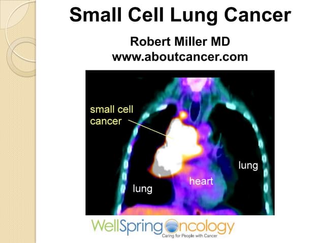 Small Cell Lung Cancer
