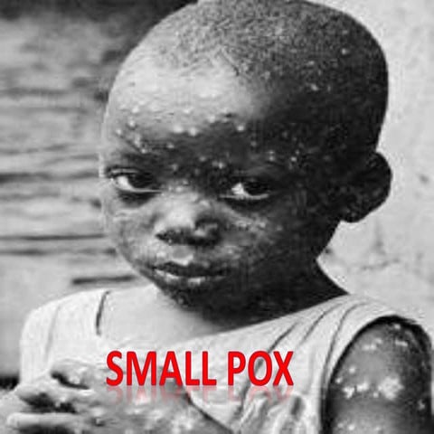 Smallpox