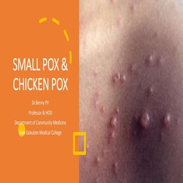 Small pox & chichen pox