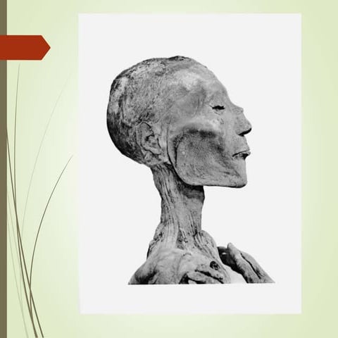 Smallpox, chickenpox,Monkeypox.ppt