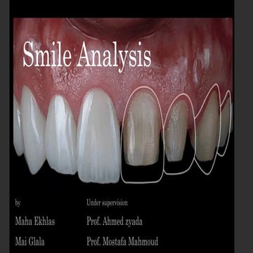 Principles of smile design | PPTX