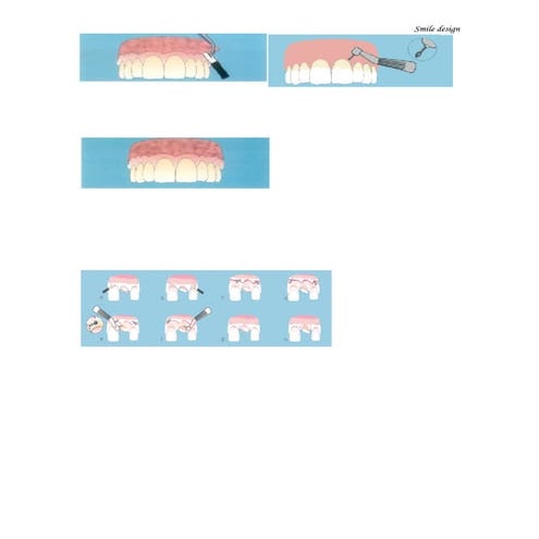 Smile design | DOC