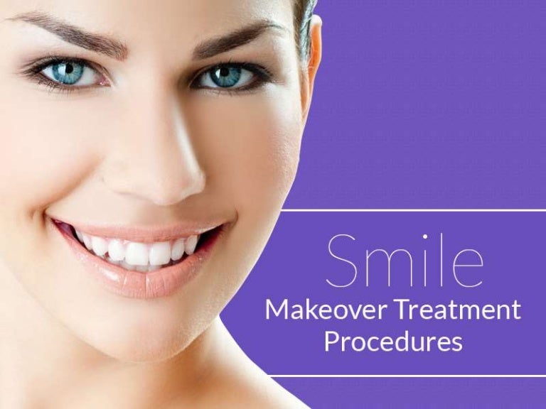Smile Makeover Procedure Confidental Dental Clinic