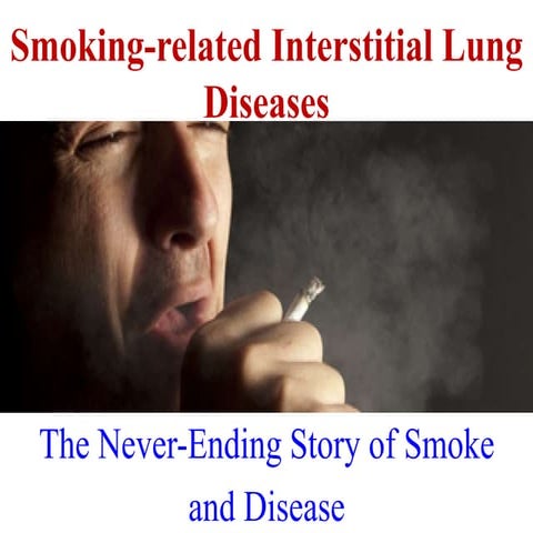 Smoking related interstitial lung diseases
