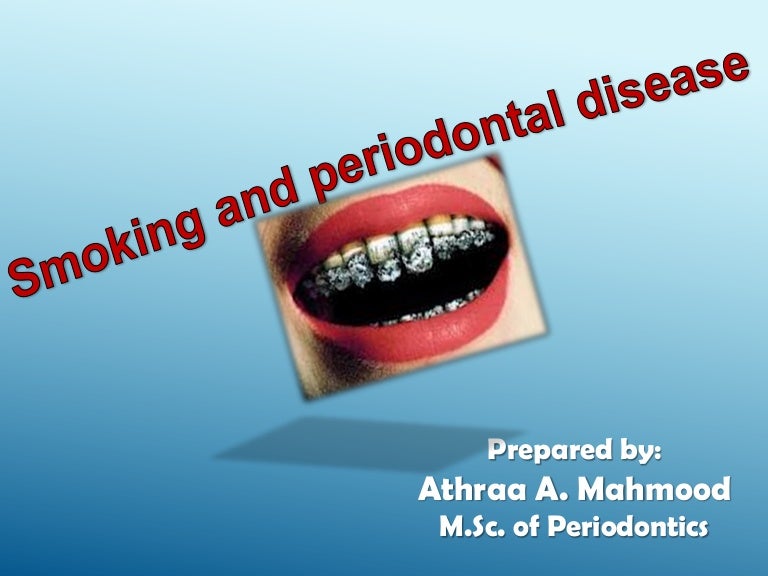 Smoking and periodontal disease