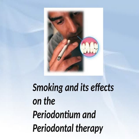 Association between Smoking and periodontal disease.pptx