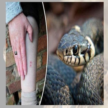 Snake bite and its management by first aid and antivenom