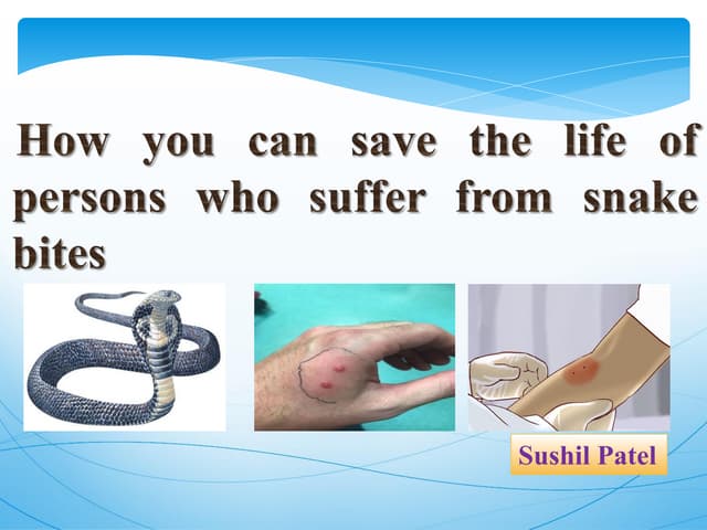 Basic safety against snake bite at work place | PPTX