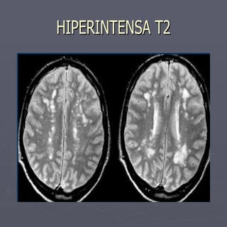 Snc clase episodio ii