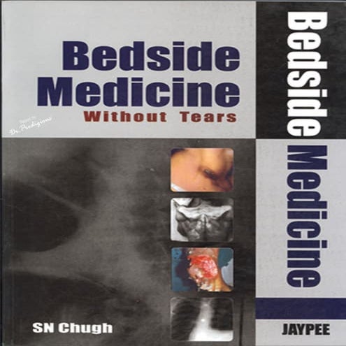 Sn chugh   bedside medicine without tears