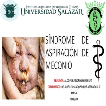 Síndrome de aspiración de meconio PPT