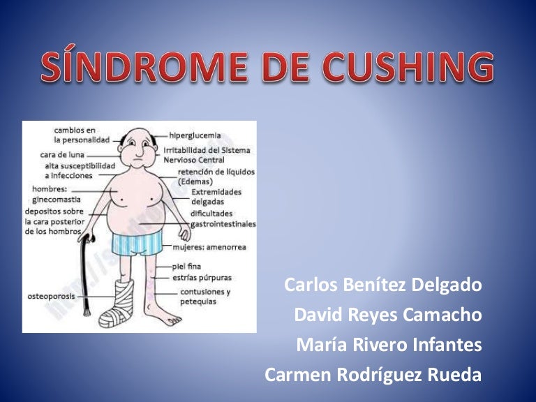 Síndrome de cushing Síndrome de cushing