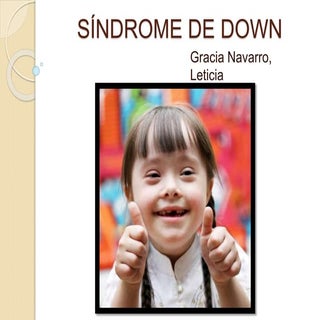 Síndrome de down