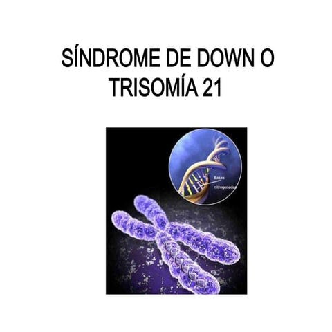 Sã­ndrome de down o trisomia 21 presentacion | PPTX