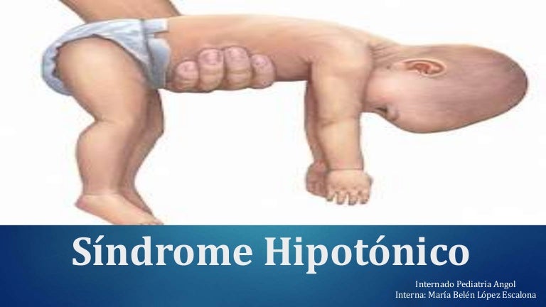 miopatía de Belén síntomas de diabetes