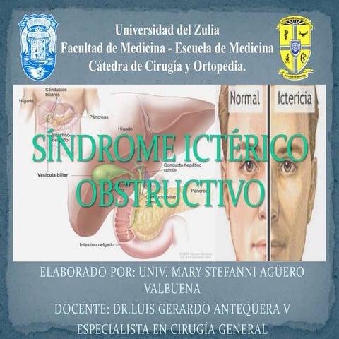 Síndrome ictérico obstructivo (GENERALIDADES)