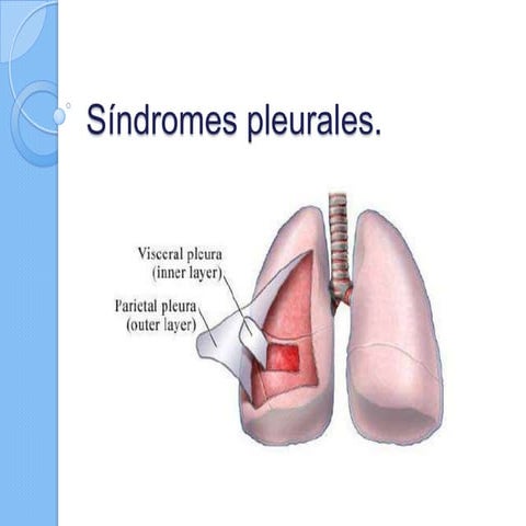 Síndromes pleurales