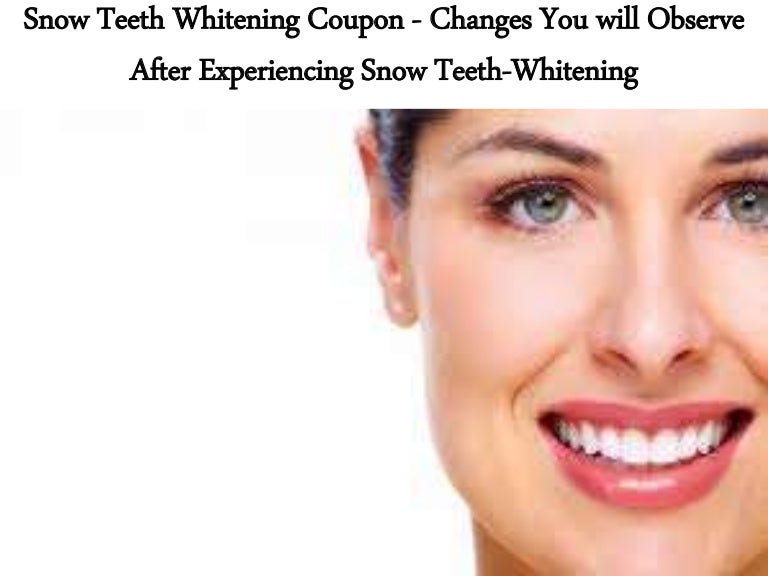 Snow Teeth Whitening Coupon Changes You will Observe After Experien…