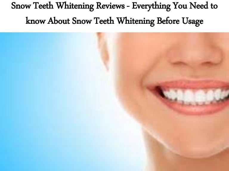 Snow Teeth Whitening Reviews Everything You Need to know About Snow…