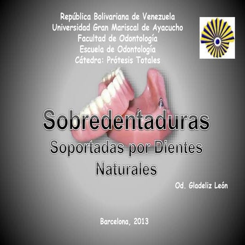 Prótesis Total Sobredentadura