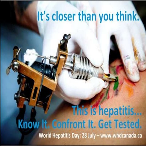 Hepatitis c 