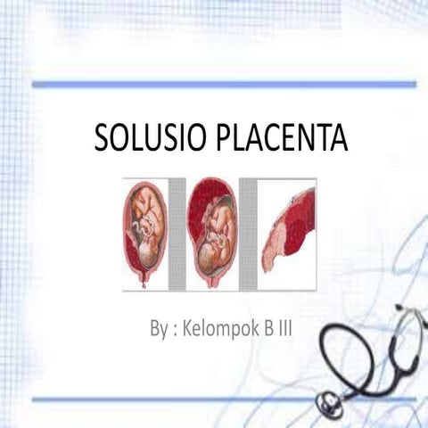 Solusio placenta